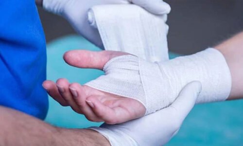 ترکیہ میں عیدالاضحیٰ کے پہلے روز جانوروں کو ذبح کرنے کے دوران 14 ہزار افراد زخمی