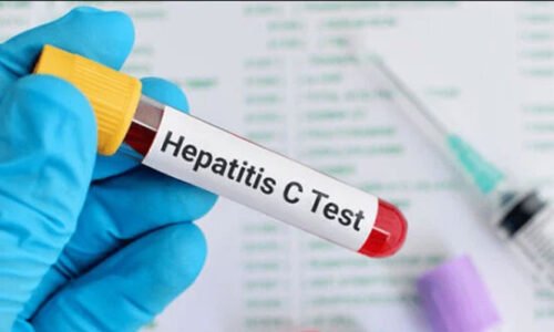 ہیپاٹائٹس قابلِ علاج، مگر پاکستان میں اس مرض سے اموات میں اضافہ کیوں؟