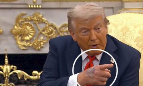 امریکی صدر ڈونلڈ ٹرمپ کے ہاتھ پر نیل، وائٹ ہاؤس نے زیادہ ہینڈ شیک کو وجہ قرار دے دیا